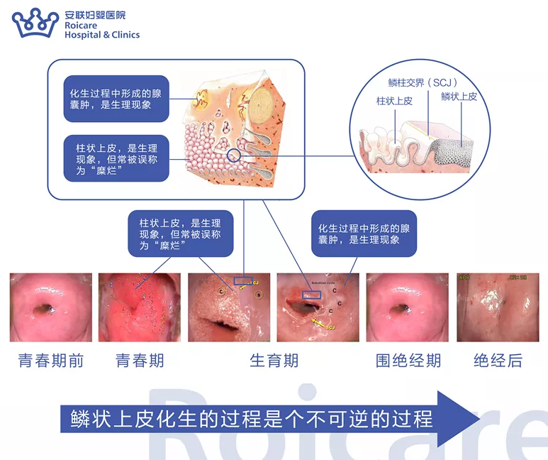 安联专家说丨宫颈癌的三级预防,越早知道越好!